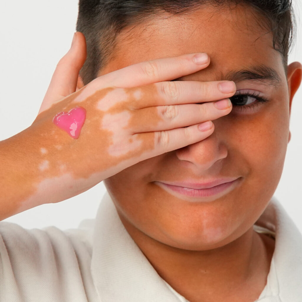 Peau sèche : comment reconnaître les signes d'une pathologie cutanée ?